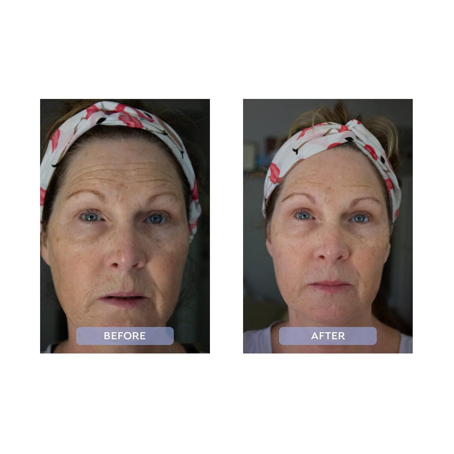 Before and after comparison of a woman wearing a headband with floral patterns.