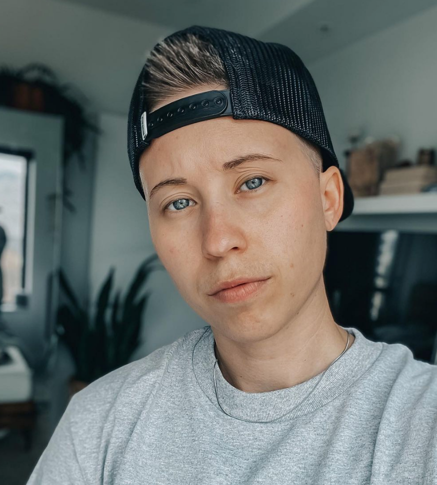 My Skin Journey | Pride Month 2021
