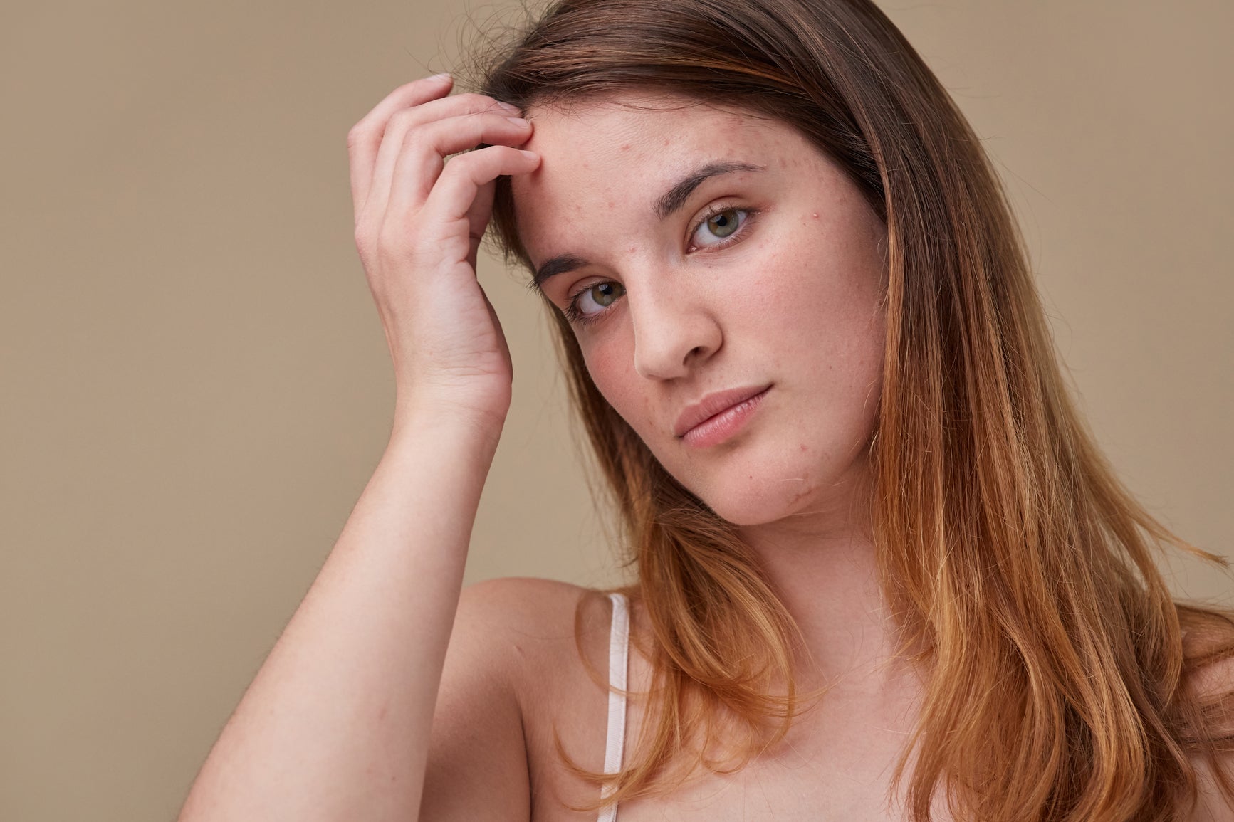 The Best Skincare Ingredients for Acne.