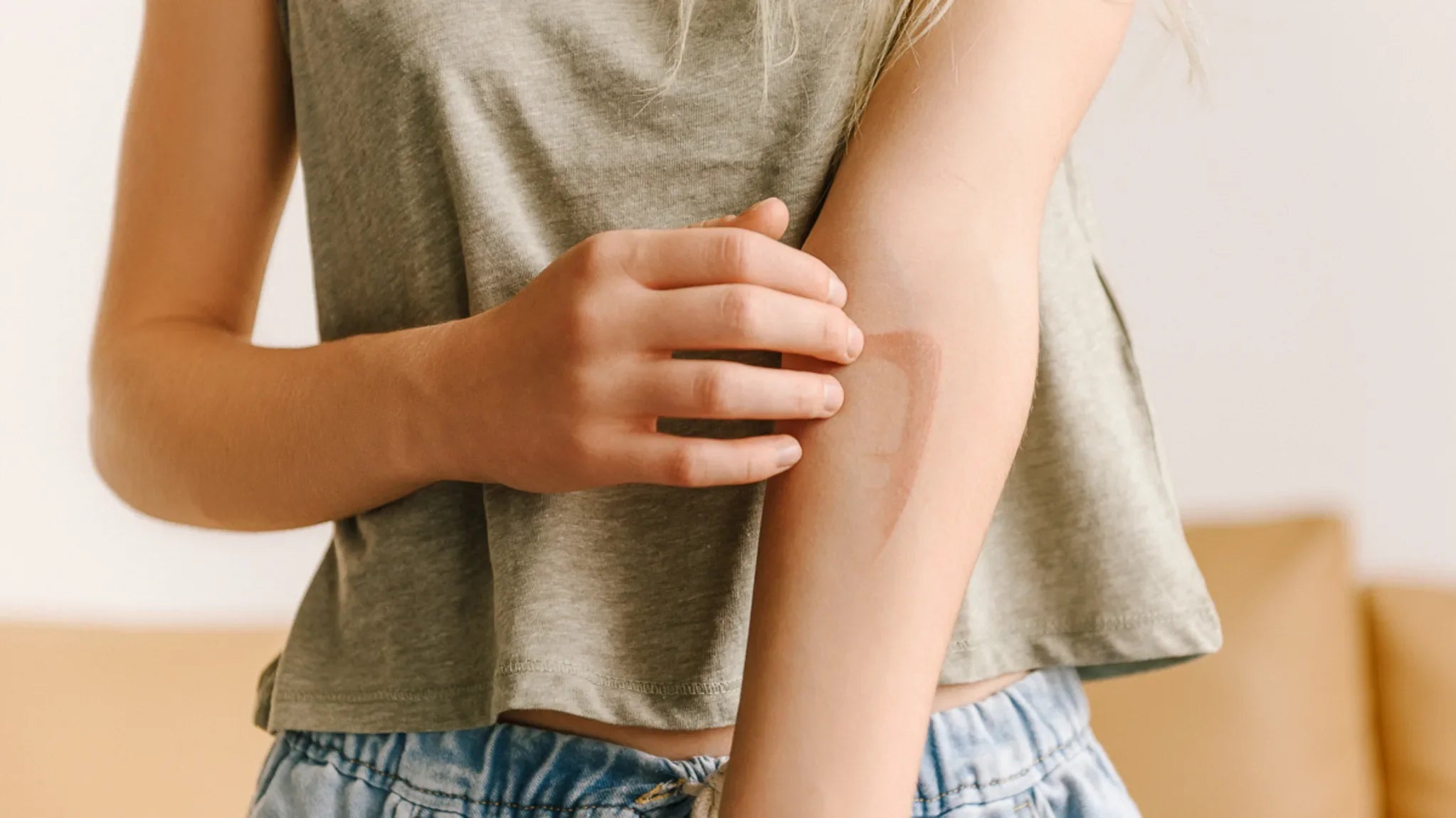 8 Best Scar Creams To Help Fade Every Type Of Cut, Scrape & Mark – Dr ...