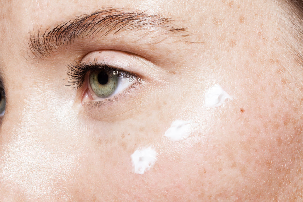 How to Reduce Dark Under-Eye Circles | Derm-Approved Treatments.