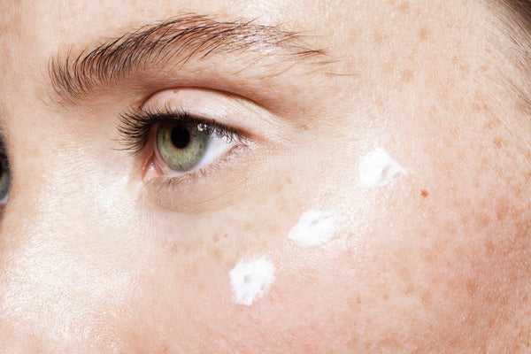 How to Reduce Dark Under-Eye Circles | Derm-Approved Treatments  