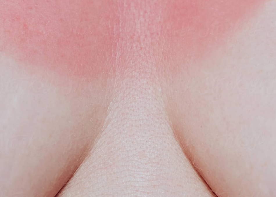 Sun Protection: How to Reduce Your Risk of Skin Cancer