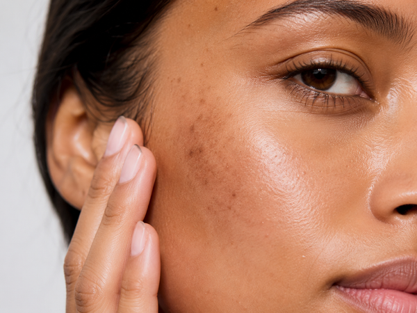 Close-up of a woman's face showing clear, radiant skin with blemishes and texture, touching her cheek against a light gray background.