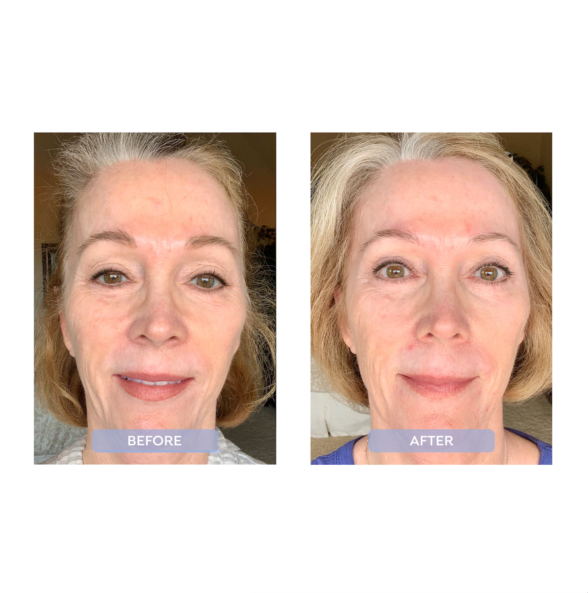 Inflam-aging Night Repair Treatment.