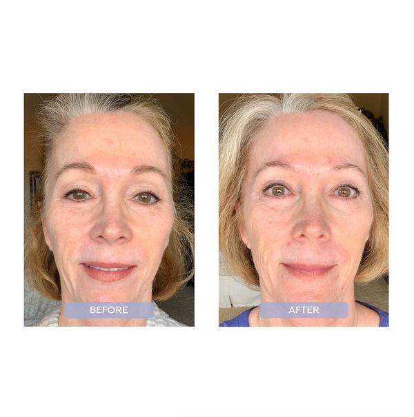 Foil Inflam-aging Night Repair Treatment