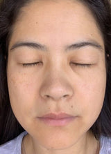 After use of Dr. Zenovia Advanced Retinol Night Repair Treatment | Clear Complexion | Hormonal Dermatology